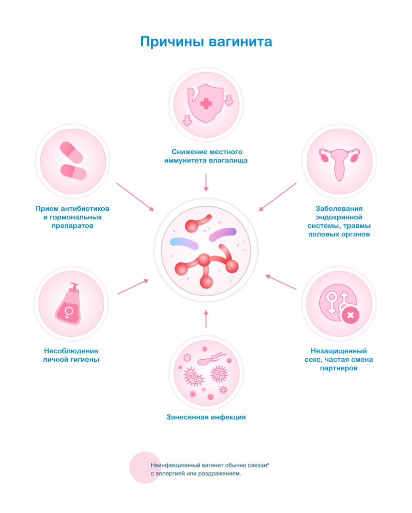 Причины вагинита