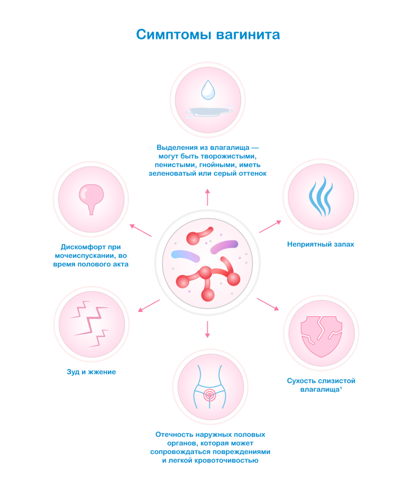 Симптомы вагинита