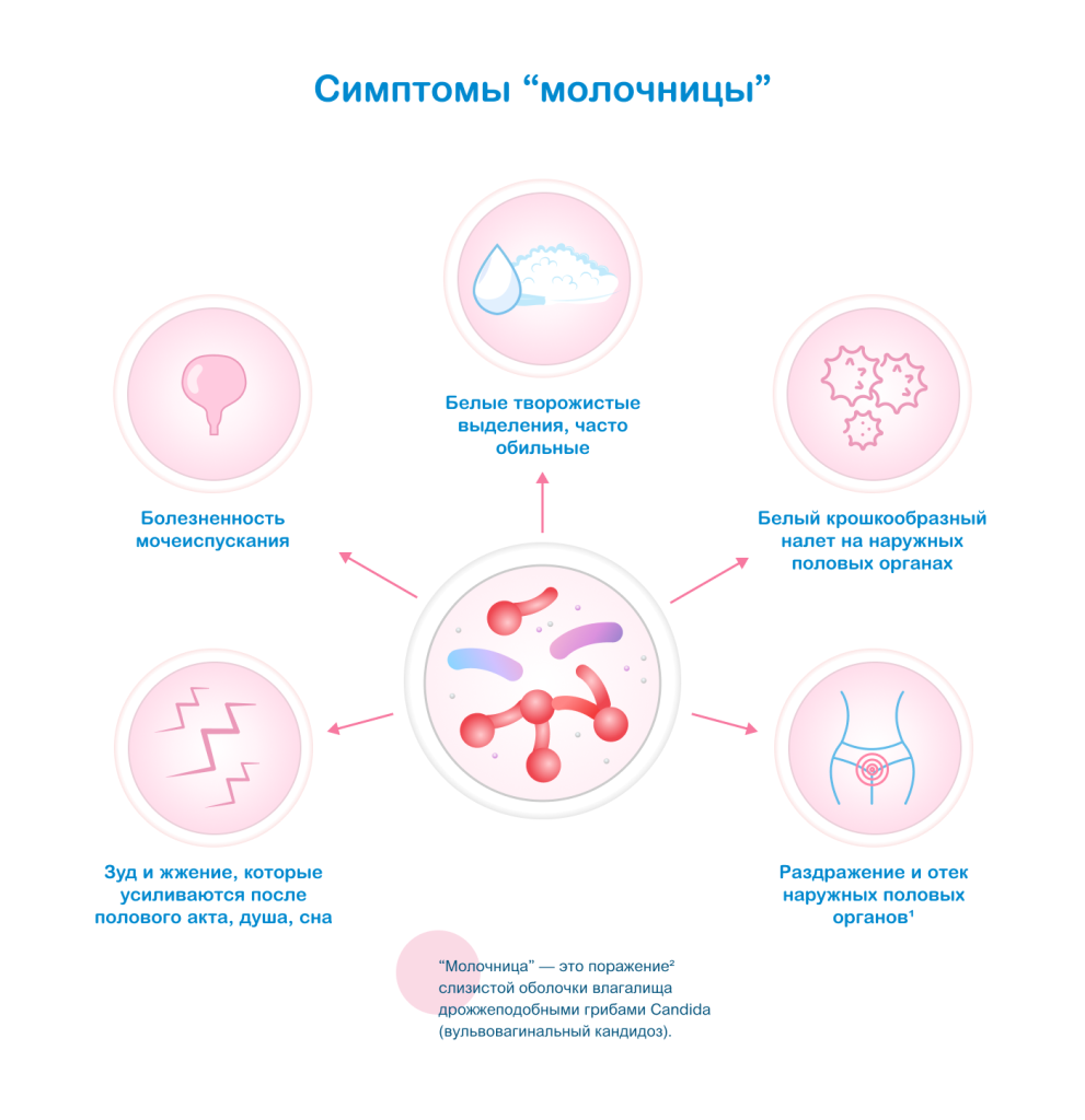 Симптомы молочницы