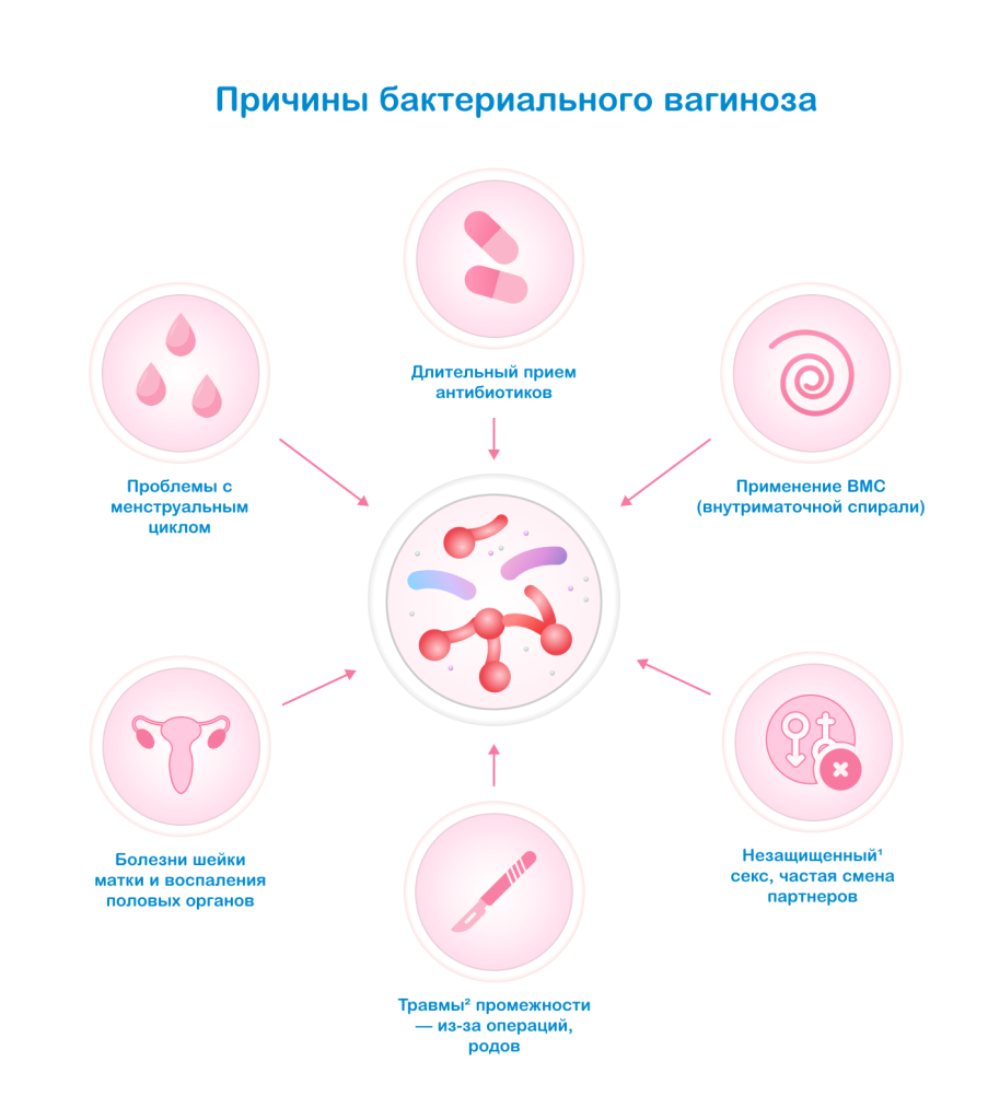 Причины бактериального вагиноза