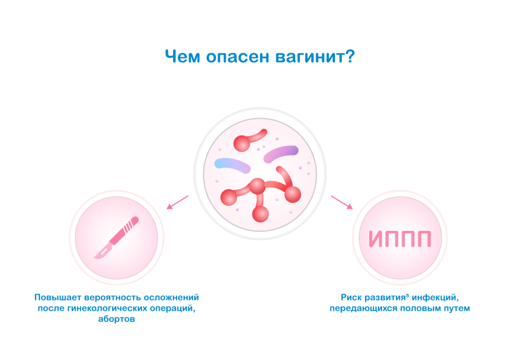 Чем опасен вагинит