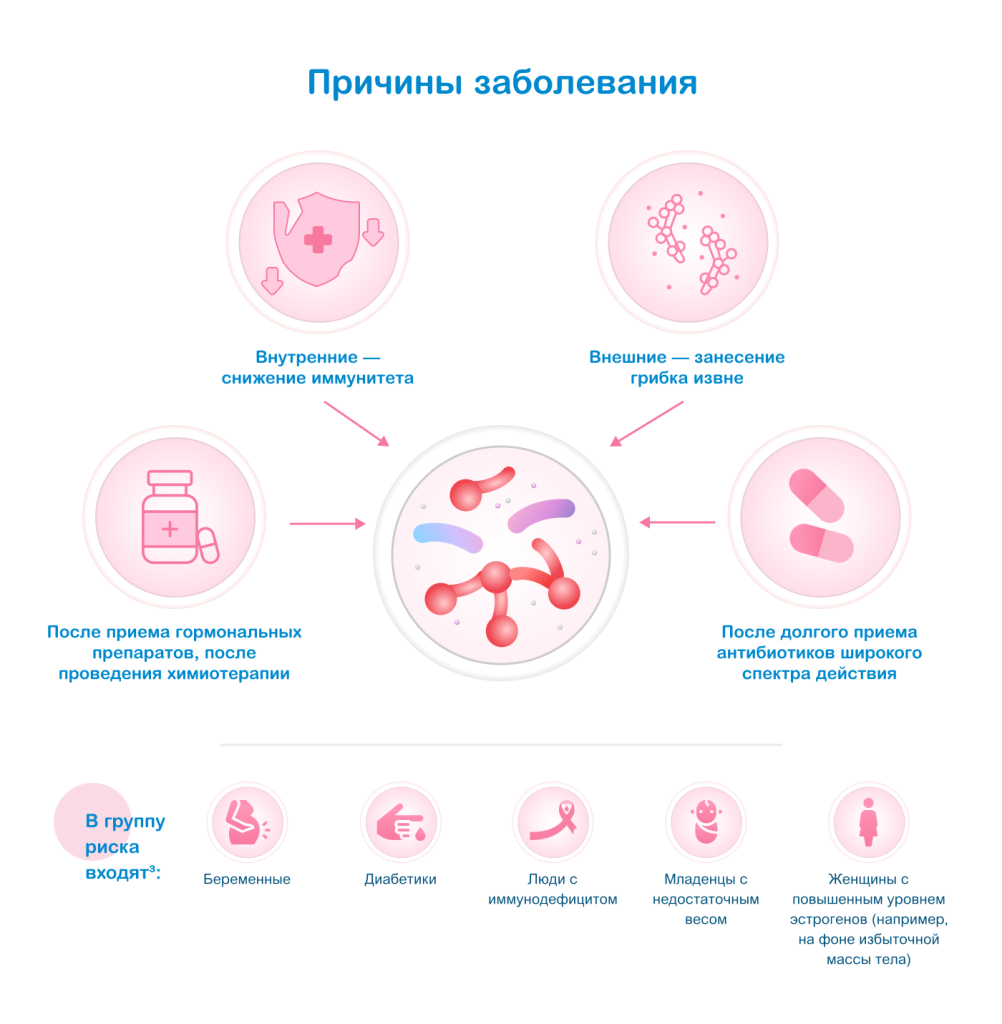 Причины заболевания